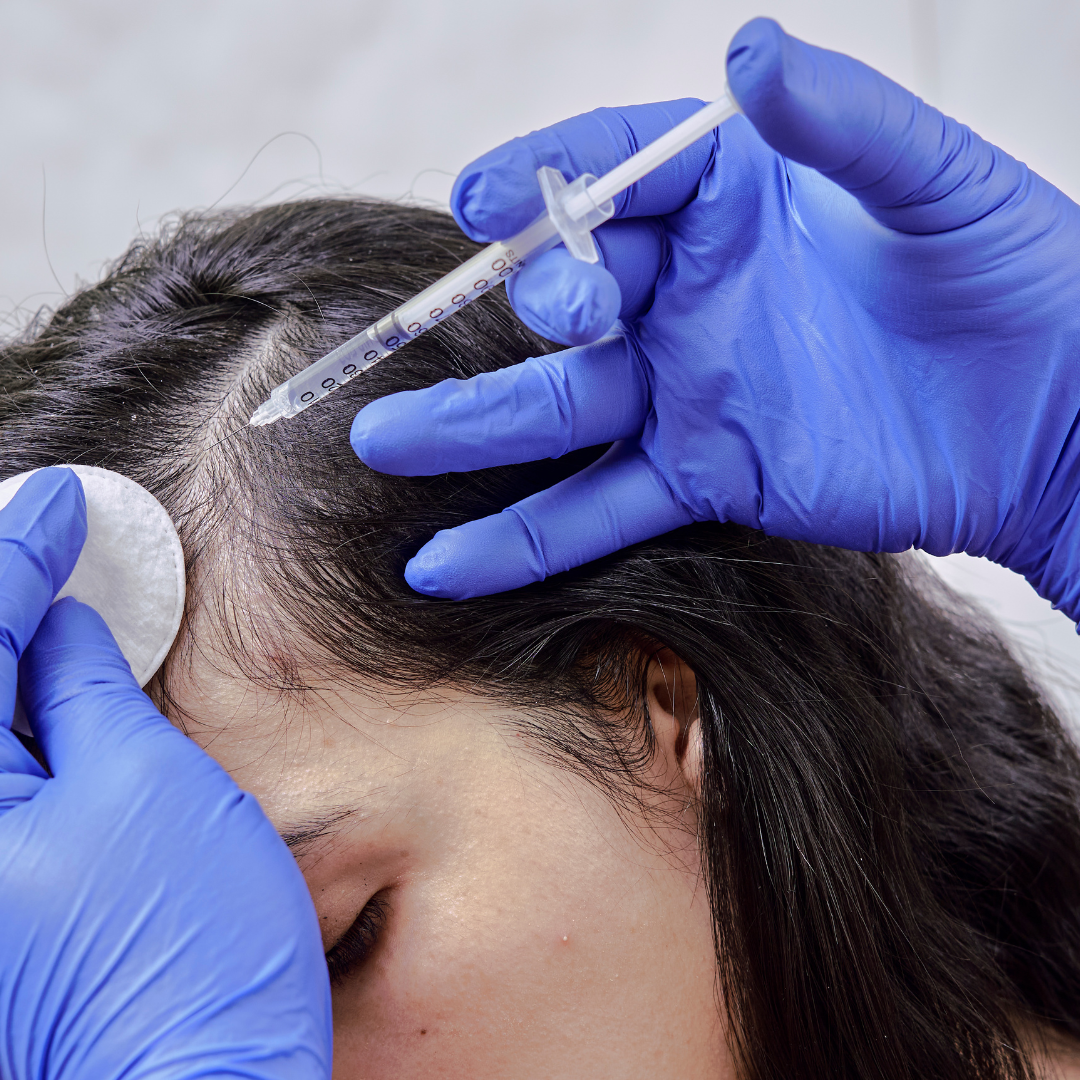 traitements chute cheveux pour retrouver des cheveux saines